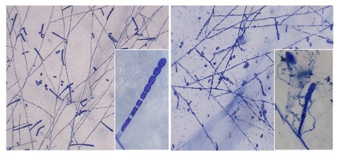 農薬を噴霧したメロンうどんこ病菌の菌糸（左）・農薬処理後に菌寄生菌の胞子を噴霧したメロンうどんこ病菌の菌糸（右）