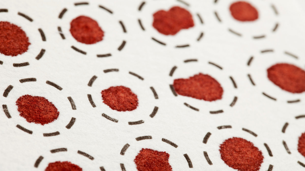 乾燥血液スポット採取カードの世界市場規模、調査、成長予測、2027年までの調査レポート