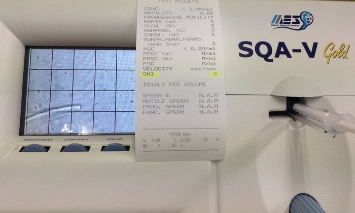 精子検査の結果(SMI:0)