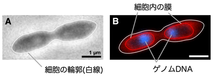 図2_RT761株の細胞に局在するゲノムDNA