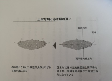 横の肩甲骨ラインの弯曲