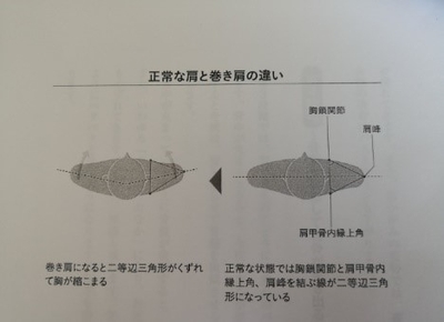 横の肩甲骨ラインの弯曲
