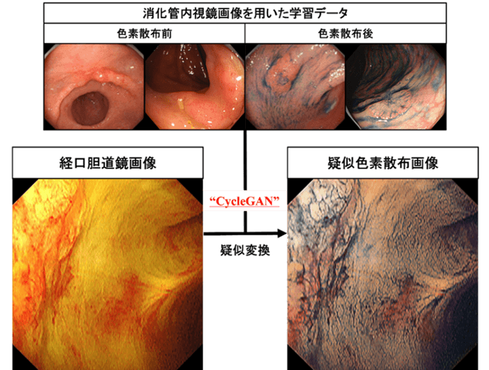 図1：白色光画像(左)から疑似色素散布画像(右)へのAIによる変換技術