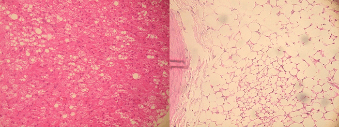 左:胸部大動脈の周囲脂肪組織、右:腹部大動脈の周囲脂肪組織