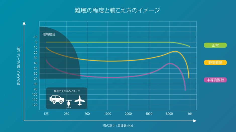 難聴により聴こえづらい部分があります