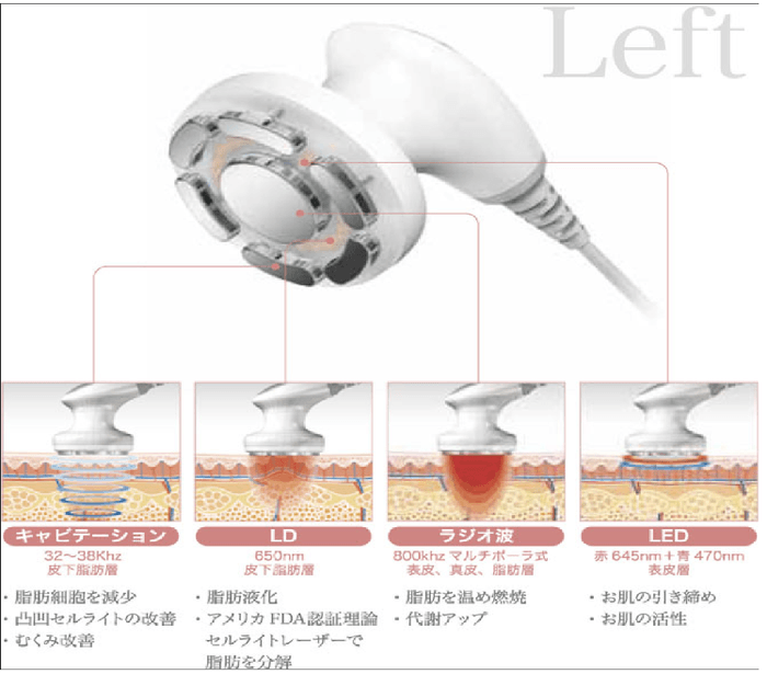 超音波ラジ