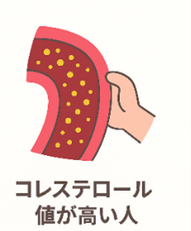 コレステロール値が高い人