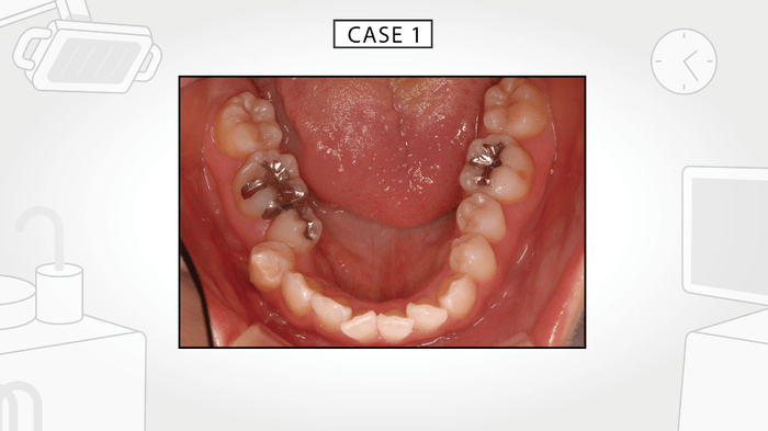 現代人の口の中