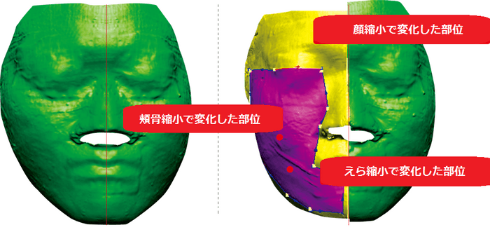 博士論文で骨と筋肉の縮小が立証された唯一のコルグンセラピー