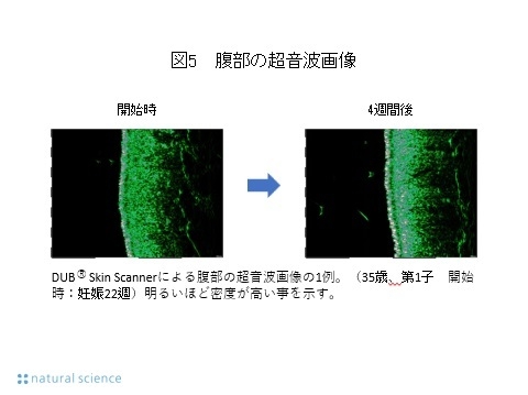 図5_腹部の超音波画像