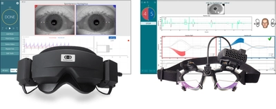 ダイアテックカンパニー、VNGおよびvHITを1台へ統合した、 眼球運動検査装置「VisualEyes 3.0(第3世代)」を5月16日に発売