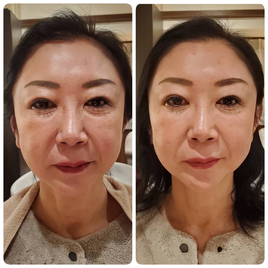 整頭術ビフォーアフター