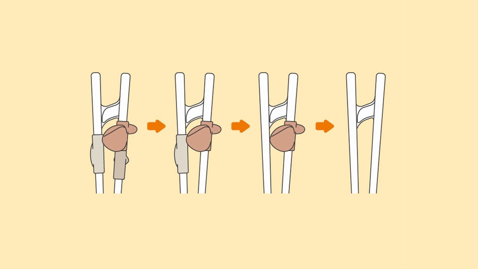 パーツを外してステップアップ