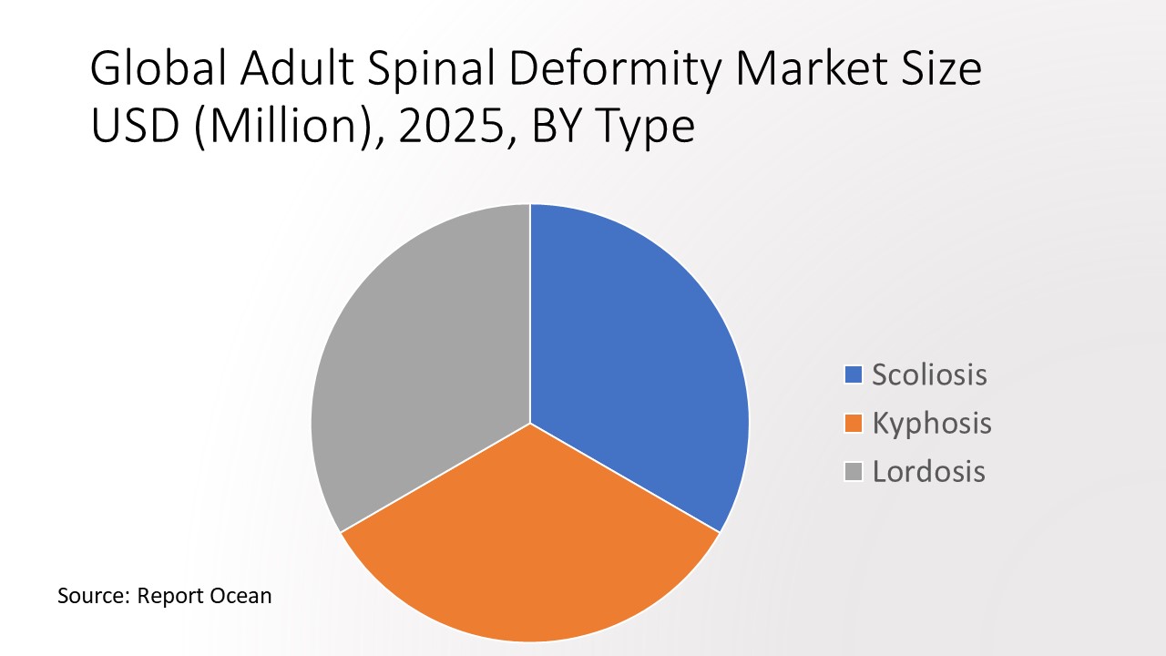 成人脊柱変形市場は、2021年から2025年まで年率7.8%で成長すると予測される