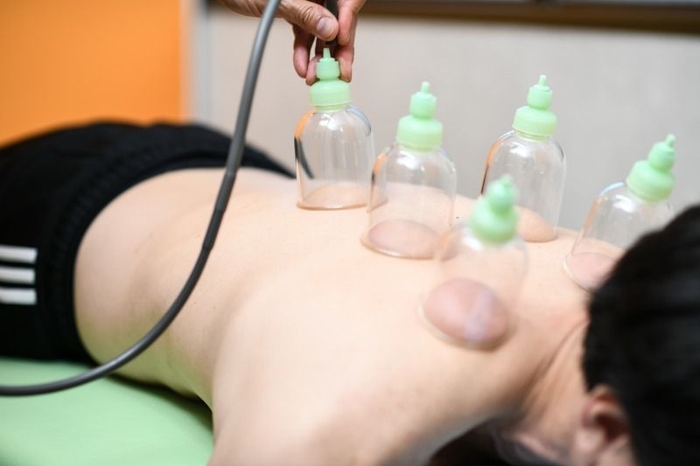 カルカル鍼灸整体院|吸い玉