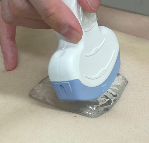 ベタつかない、拭き取り不要な超音波診断用のゲルパッドを開発　今後臨床応用することで、検査時の患者満足度向上に期待