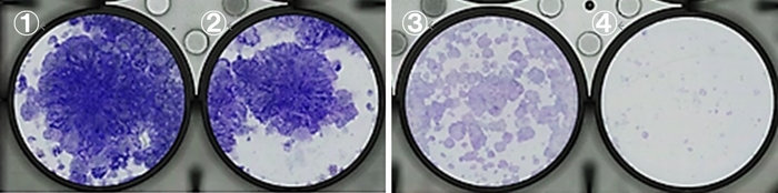 図2 肺がん細胞株を用いた薬剤感受性試験 ①無治療 ②パトリツマブ デルクステカン単剤治療 ③オシメルチニブ単剤治療 ④併用治療