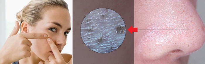 顔のお肌のトラブルによる男女共通の悩み