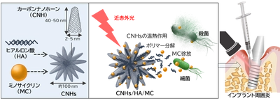 【名城大学・北海道大学】インプラント周囲炎に対する光応答性ナノ複合体を開発