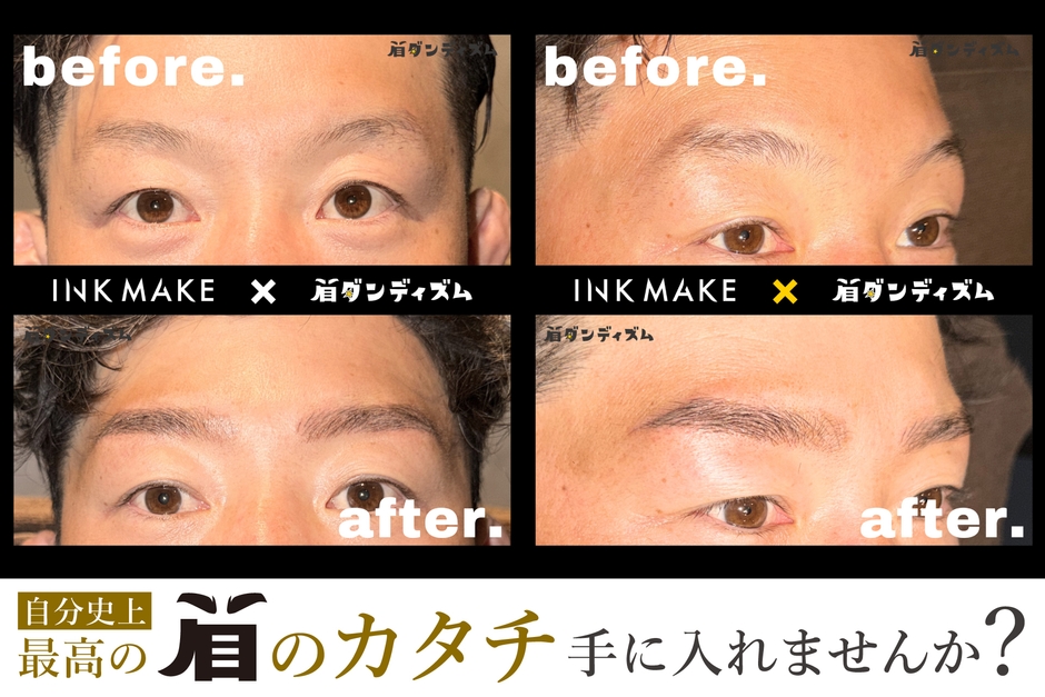 Before/After (2)
