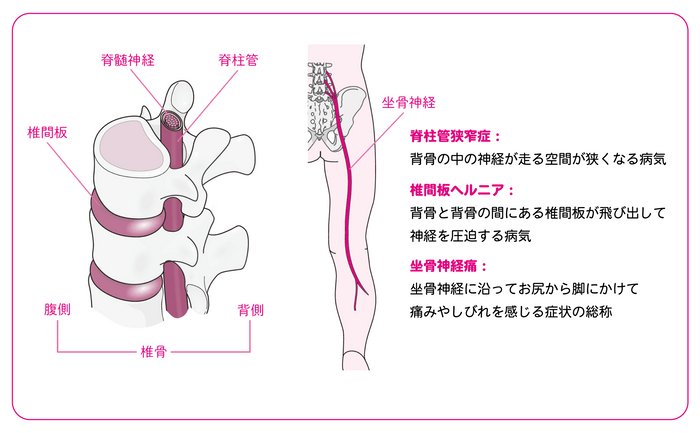 痛みやしびれを伴う代表的な疾患