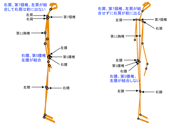 　　　　　図1（Ⅰ型タイプの『Csc』画像　　　　　　　　　　　図2（Ⅱ型タイプの『Csc』画像）