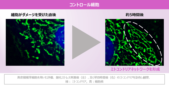 図2 コントロール細胞でのミトコンドリアネットワーク形成