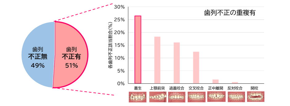図1　各歯列不正者の割合