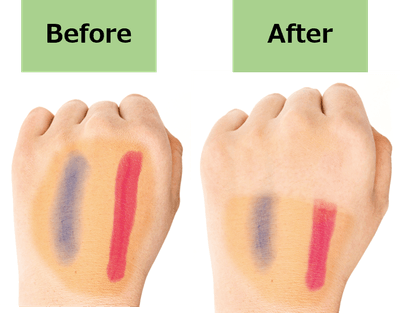 Before/After