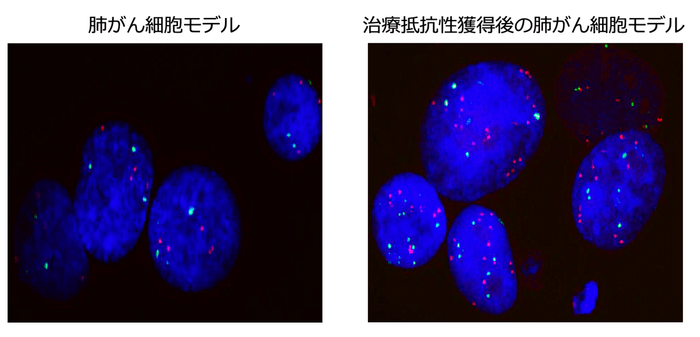 KRAS阻害薬抵抗性獲得前後におけるMET遺伝子のFISH画像の比較