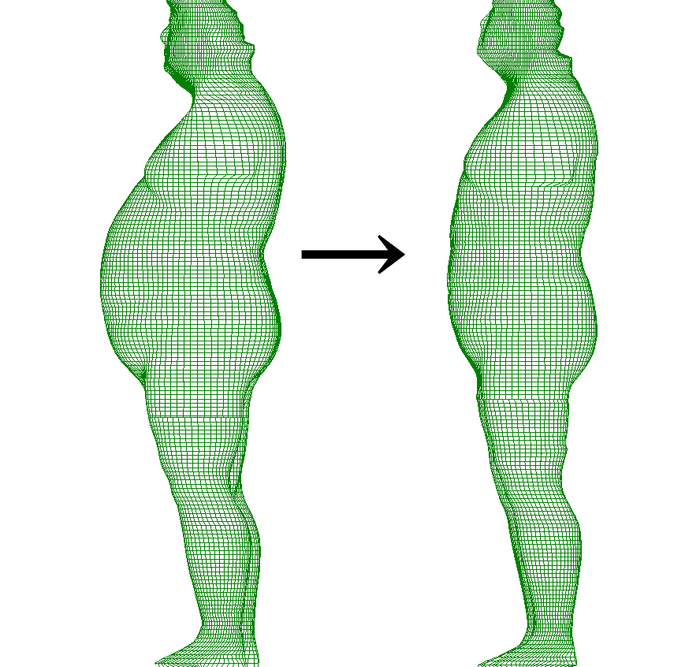 Before/After 3D画像