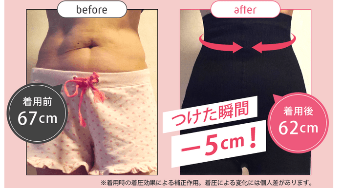 ストレグお腹Before／After