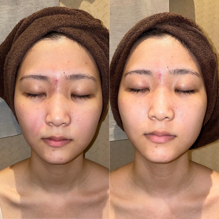 使用感、ビフォーアフター