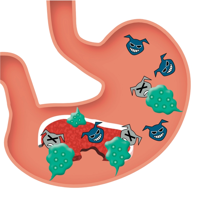 Photo.07 胃の中で塩酸がバイキンをやっつける(イメージ図)