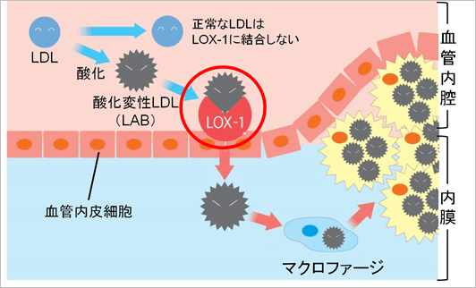 図6　動脈硬化の進行メカニズムとLOX-index(R)