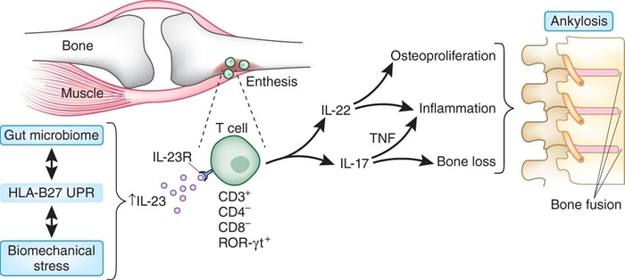 図2:脊椎関節炎の病態