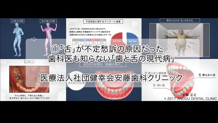 歯科医もしらない「歯と舌の現代病」