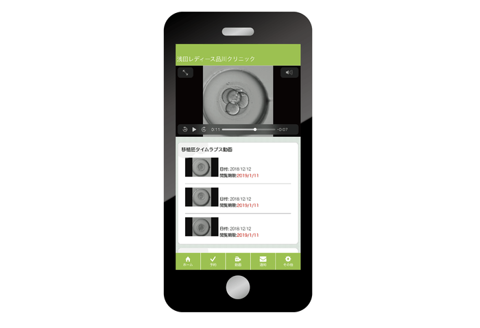 受精卵の映像閲覧画面