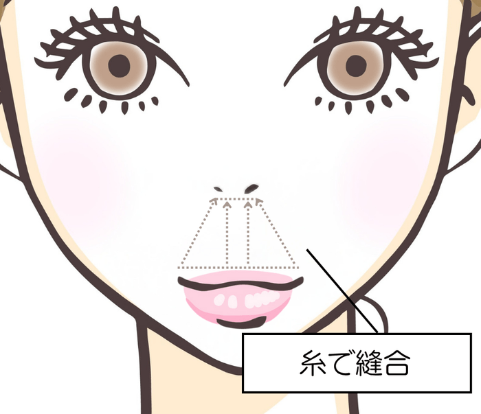 施術イメージ(2)