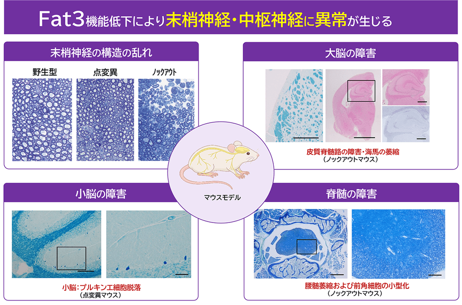 図3：マウスモデルによる神経系への影響 FAT3遺伝子の機能低下により、末梢神経の構造異常と、大脳・小脳・脊髄にわたる広範な神経障害が生じることが確認された。