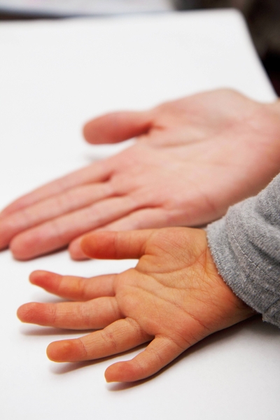 みかんを食べると手が黄色くなるのはβ-クリプトキサンチンの蓄積のため