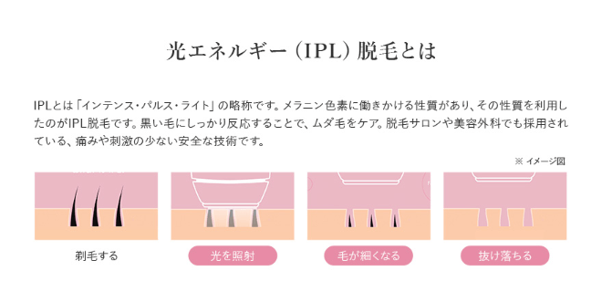 光エネルギー（IPL）脱毛とは