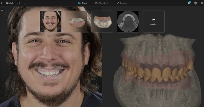 ブループリント