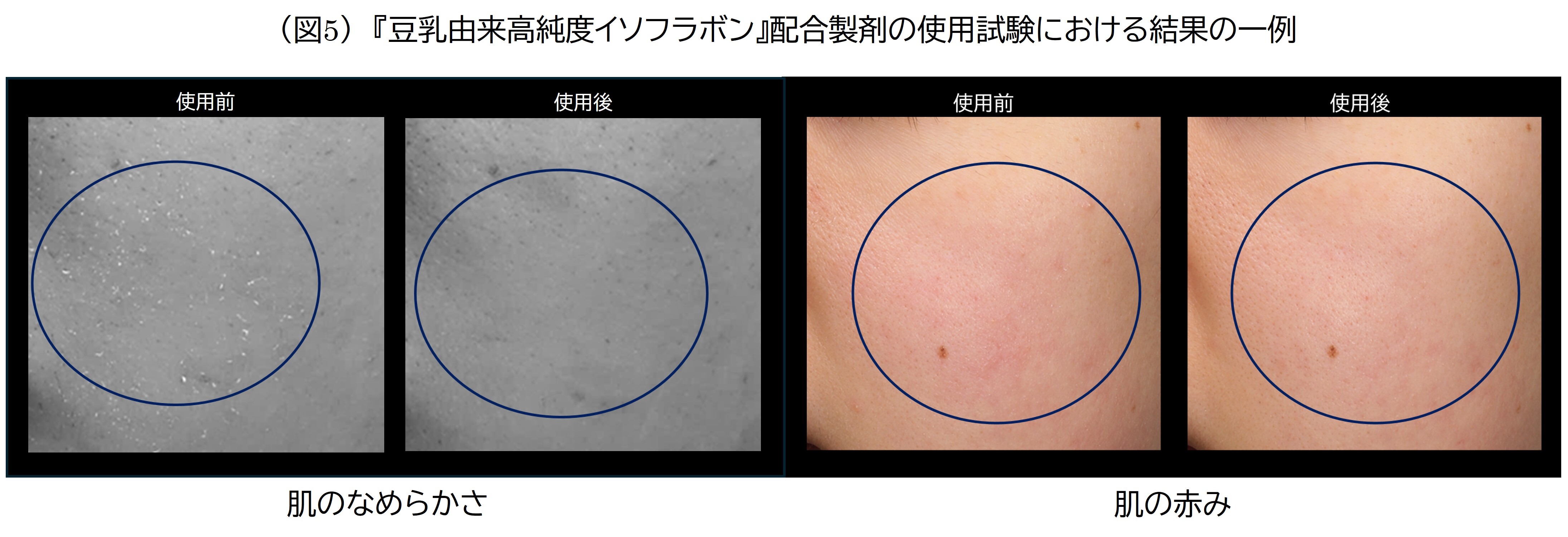 (図5)豆乳由来高純度イソフラボン配合製剤の使用試験における結果の一例