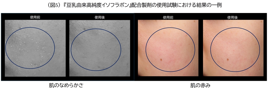 (図5)豆乳由来高純度イソフラボン配合製剤の使用試験における結果の一例