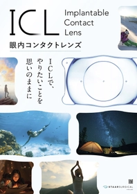 今年の夏はコンタクトのストレスをゼロに。旅行やプールを「裸眼」で思い切り楽しむ視力矯正「ICL」の魅力