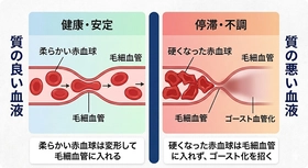 睡眠中の“呼吸構造の新変化”が血液の質を乱す──睡眠の質の低下につながる体内環境の乱れを新たに確認