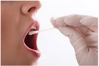 検査のサンプル採取はeasy&speedy