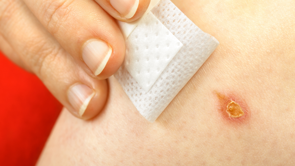 火傷治療センターの市場規模は2028年までに327.3億ドルに達する見込み