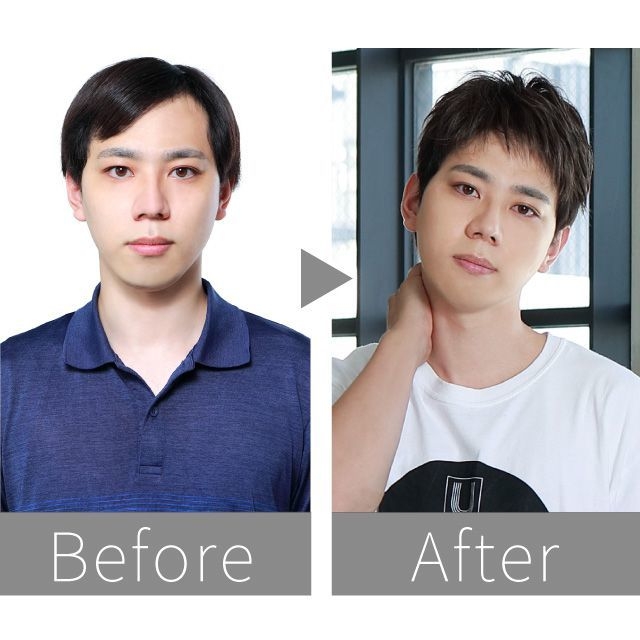 ビフォー アフター